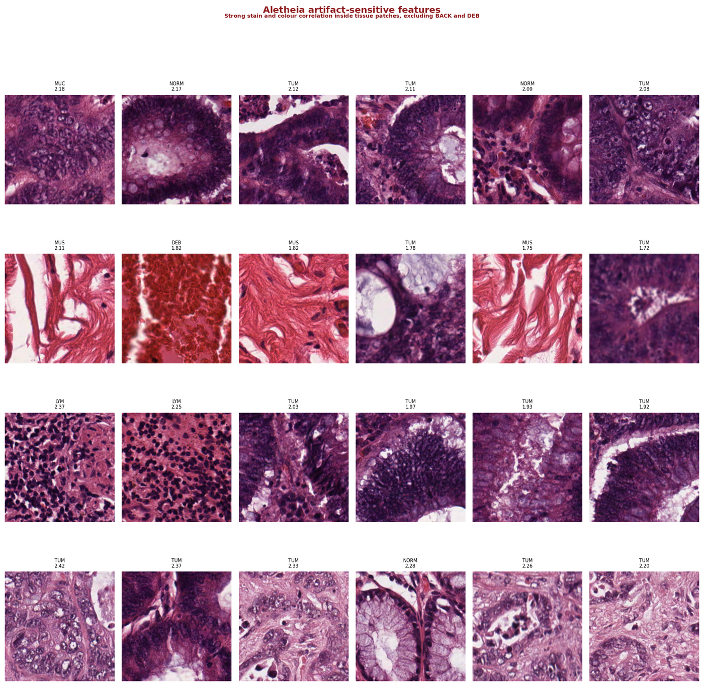 Artifact-sensitive features — top-activating patches with strong stain and colour correlation
